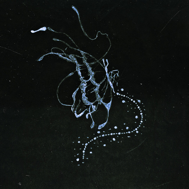 'Baby Te Extraño (Remix)' cover art