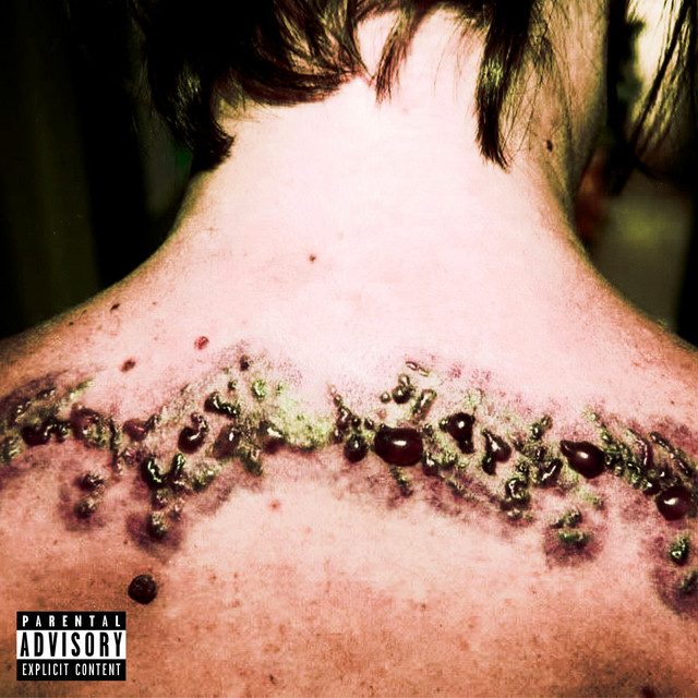 'BLISTERS' cover art