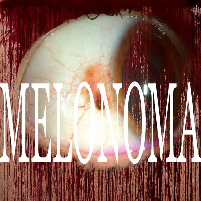 'MELONOMA' cover art
